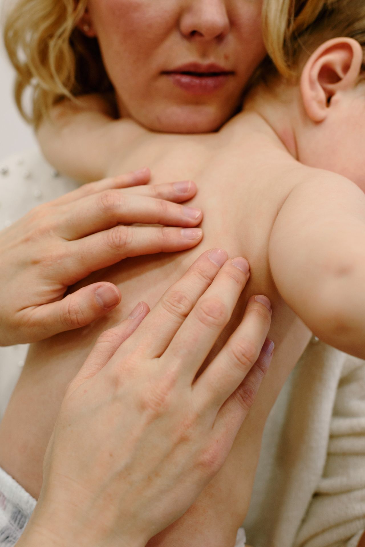 Viêm da cơ địa ở trẻ em - Bé bị chàm tái đi tái lại có chữa dứt điểm được không?
